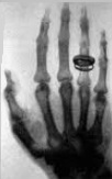 Discovery of X-rays